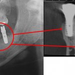 3d image of teeth