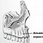 Alveolar ridge