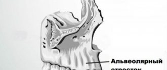 Alveolar ridge