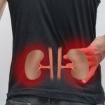 Kidney diseases