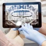 What does a CT scan of the jaw show when diagnosing serious diseases?