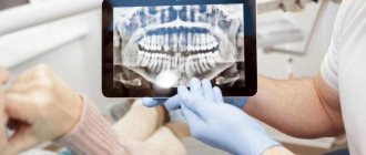 What does a CT scan of the jaw show when diagnosing serious diseases?