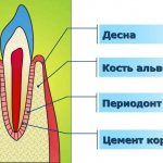 Что такое рецессия десны