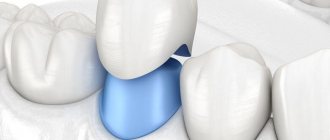 What awaits the patient after endodontic therapy?