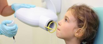 детский рентген зубов