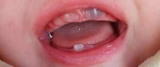 If the cause of the blue discoloration is a growing tooth, then the symptoms may resolve on their own