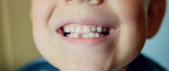 Are there nerves in baby teeth?