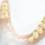 Photo of a clasp denture for children