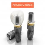 Photos of Ostem implants