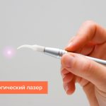 Photo of a dental laser