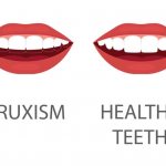 how to get rid of bruxism