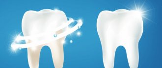 Как восстановить эмаль зуба