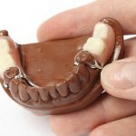 Which clasp dentures are better for teeth?