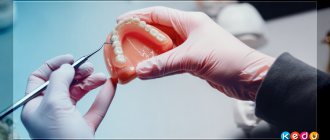 Dental Technician Career