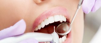 caries causes and prevention