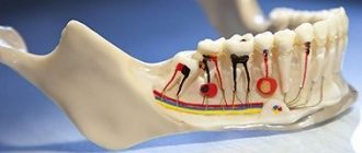 Tooth cyst