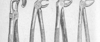 Beak-shaped forceps for the lower jaw