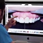 Techniques used for smile design