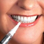 Reviews from dentists about teeth whitening pencils