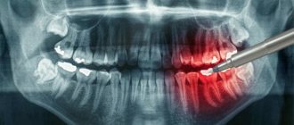 panoramic photo of teeth according to compulsory medical insurance