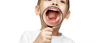 Trimming the frenulum of a child&#39;s tongue. Why is it needed? 