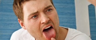 Causes of sores in the mouth