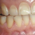 Causes of the disease - Dentistry &quot;Line of Smile&quot;