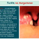 Taste of garlic in the mouth. Causes, what the symptom means 