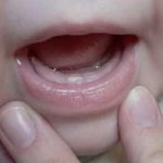 Signs of teething in a baby