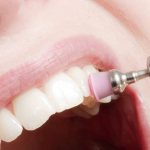Профессиональная чистка зубов доступна в каждой клинике