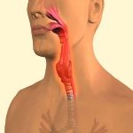 Manifestations of pharyngomycosis