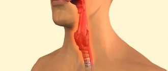 Manifestations of pharyngomycosis