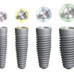 Variety of implants