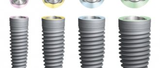 Variety of implants