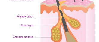 Sebaceous gland.jpg