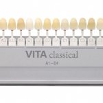 Vita scale