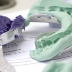 Снятие слепков челюстей стоматологическими ложками