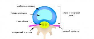 Disk structure