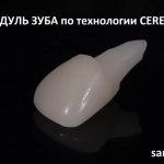 Так выглядит модуль зуба с корнем, выполненный по технологии Cerec. Время изготовления 10 минут.