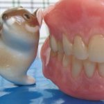 Subtleties of dental treatment and prosthetics in Heihe