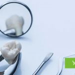 Tooth extraction