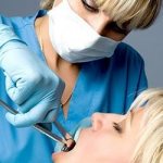 Tooth extraction