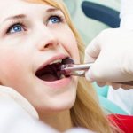 The doctor may leave pieces of the tooth root in the socket or injure the gums