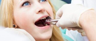 The doctor may leave pieces of the tooth root in the socket or injure the gums