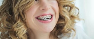 Woman with braces